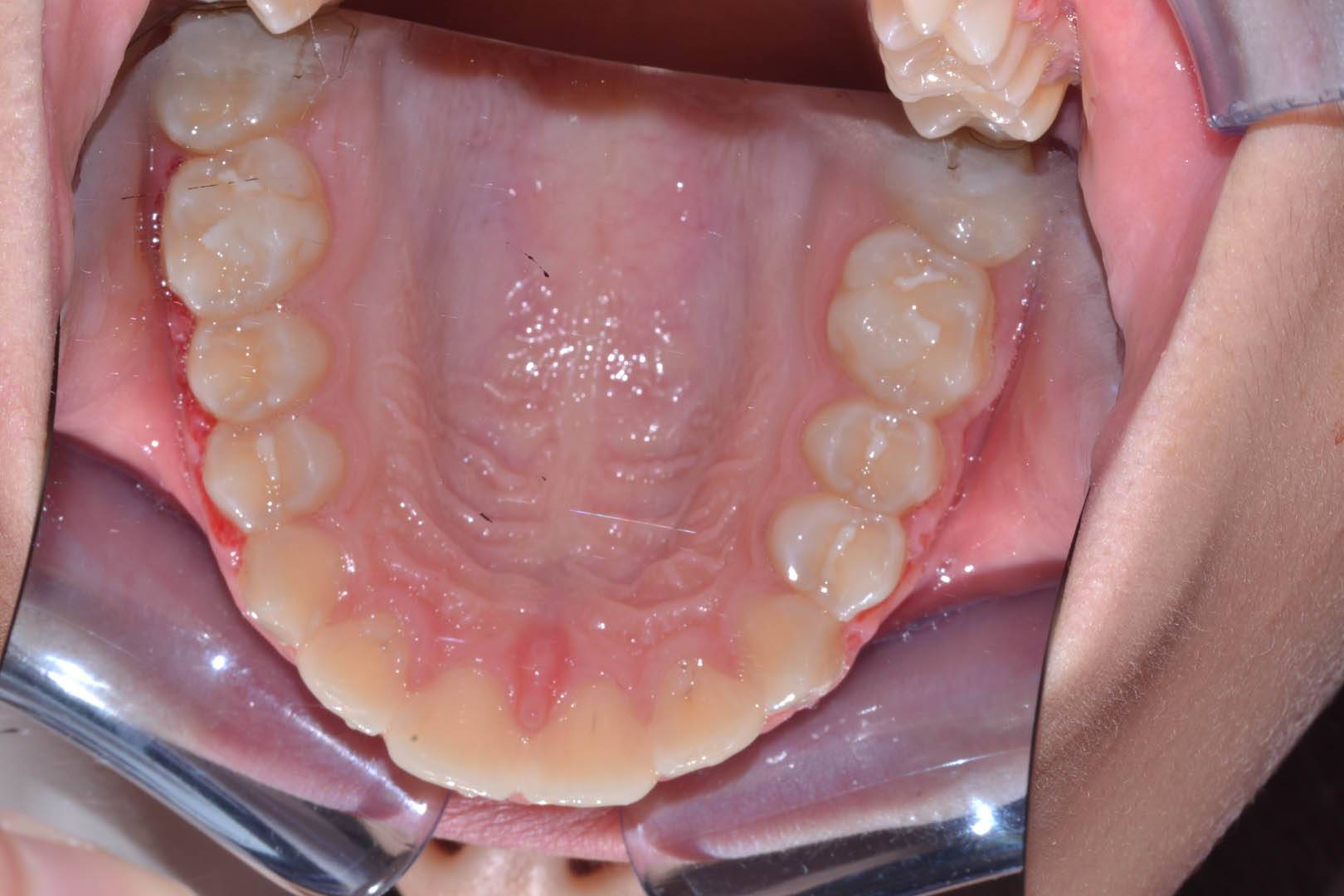 odontocentro-monza-brianza-ortodonzia-fissa- ( (9)