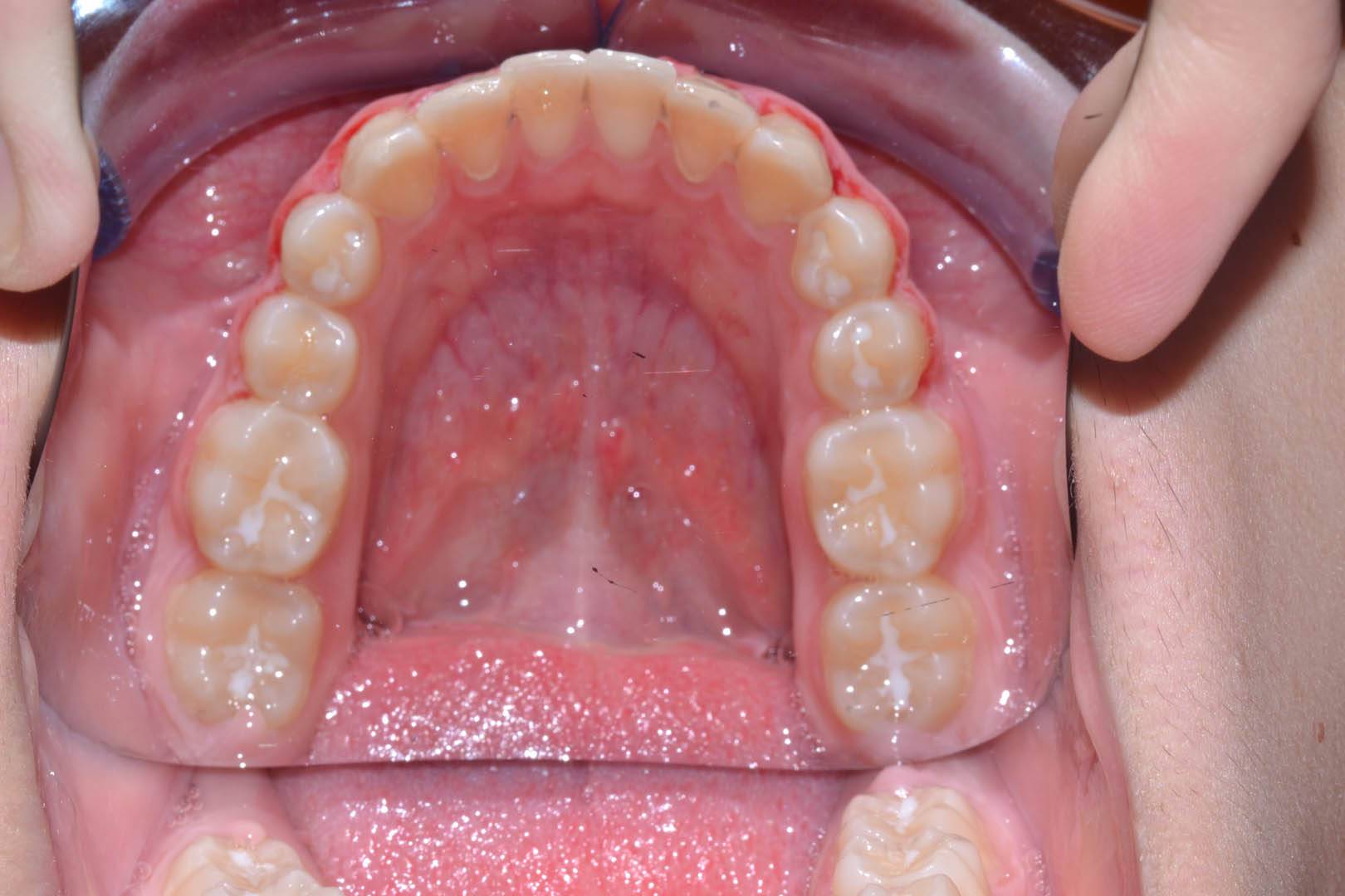 odontocentro-monza-brianza-ortodonzia-fissa- ( (10)