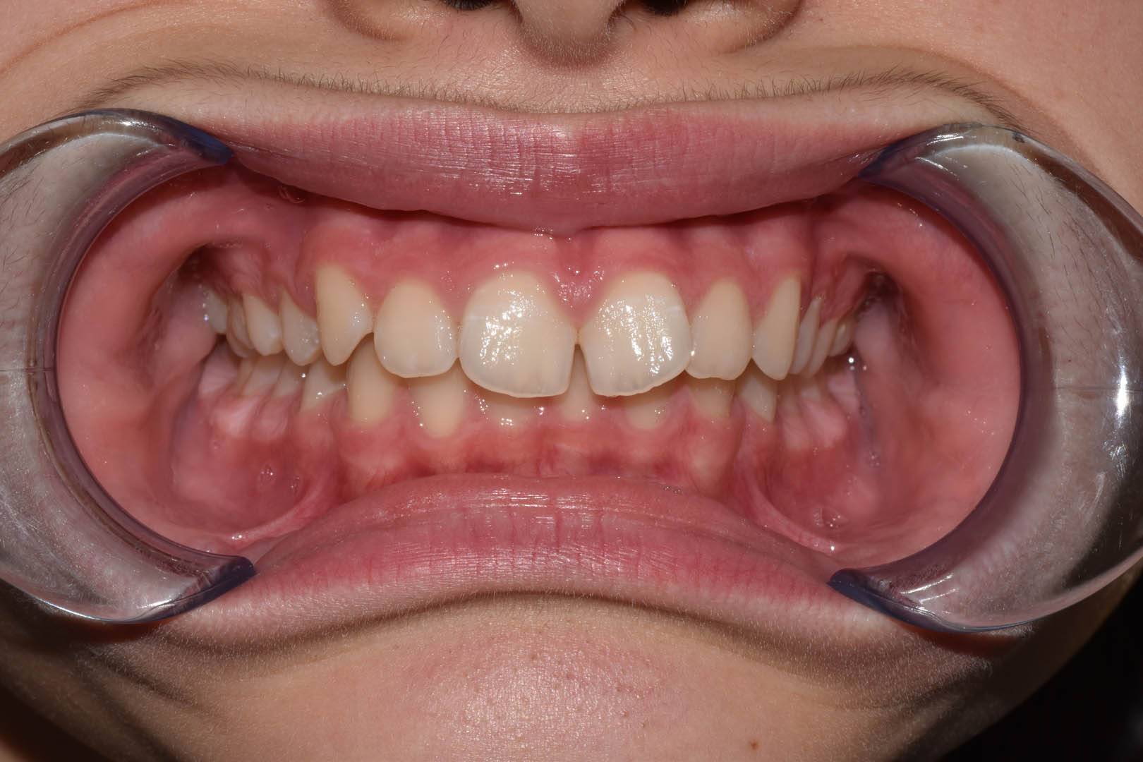odontocentro-monza-brianza-ortodonzia-fissa- (1)