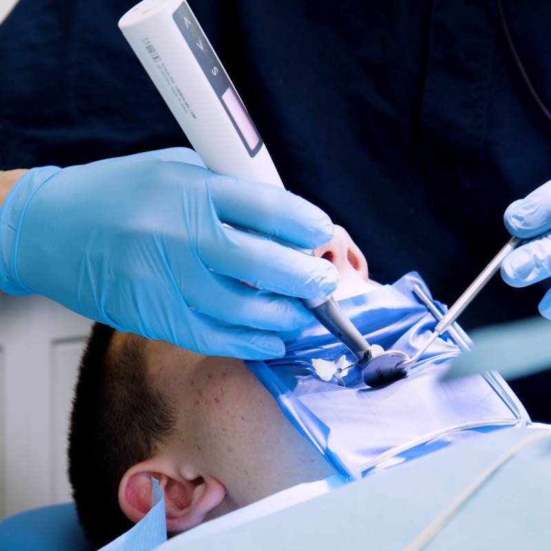 odontocentro-monza-brianza-endodonzia (2)