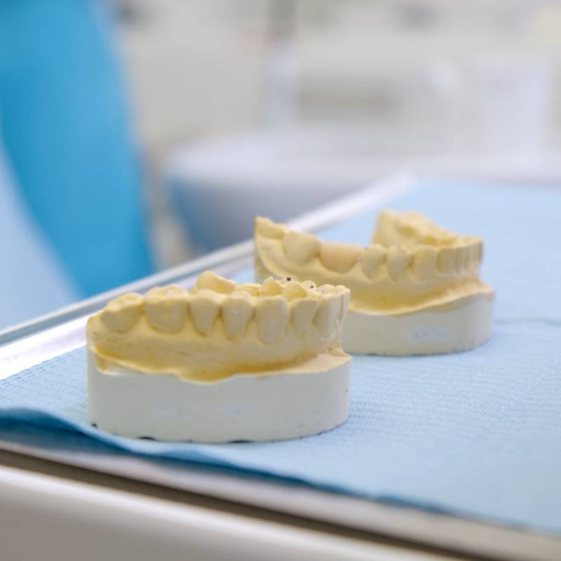 odontocentro-monza-brianza-protesi-dentali